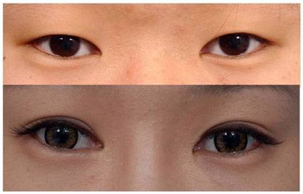 tham-my-mat.jpg